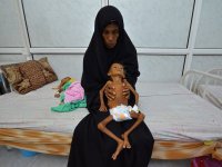 yemen-famine-616939794.jpg
