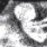 Fetus-American